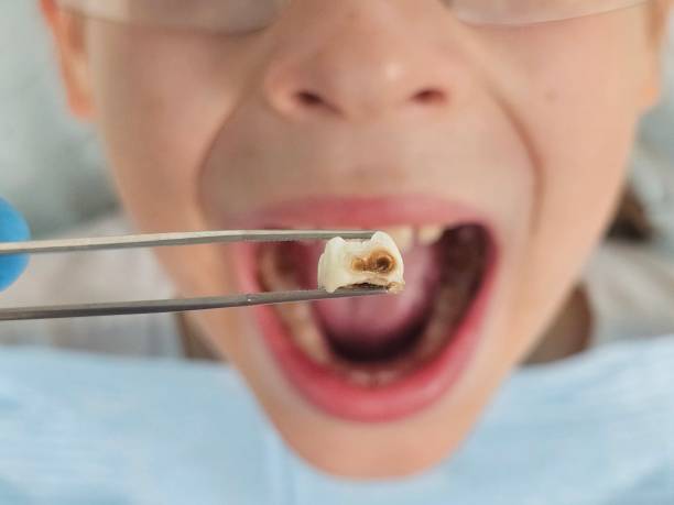Best Walk-In Emergency Dental Services in Foster City, CA